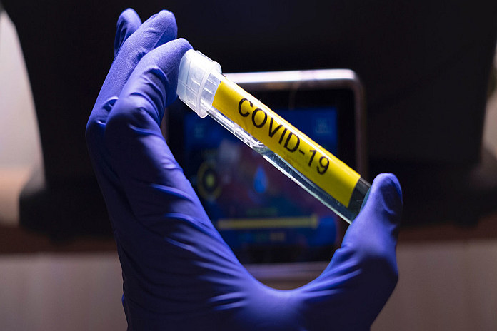covid-19 test