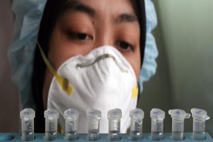 influenza