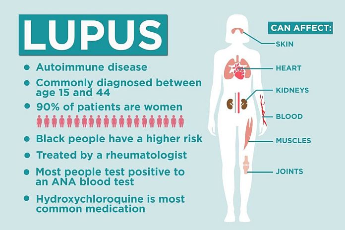 Lupus