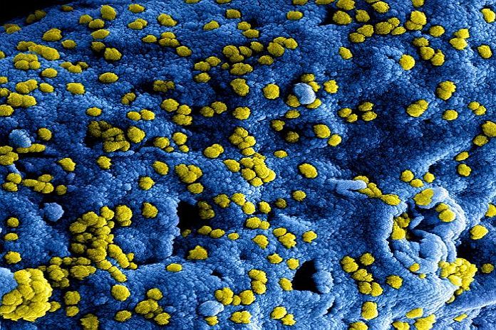 coronavirus_closeup