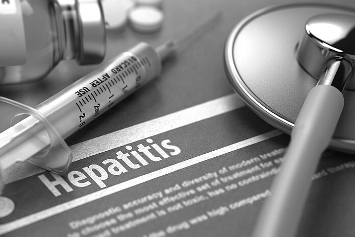hepatitis