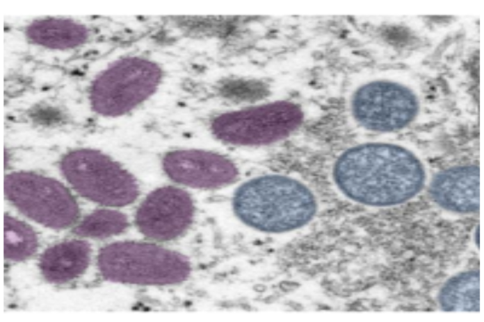 mpx_pathogen