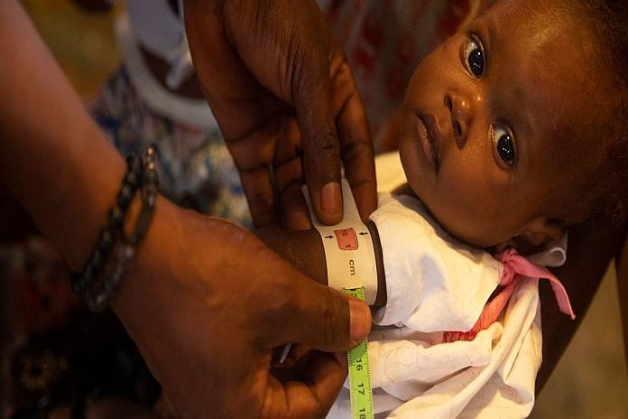 malnutrition_Cité Soleil