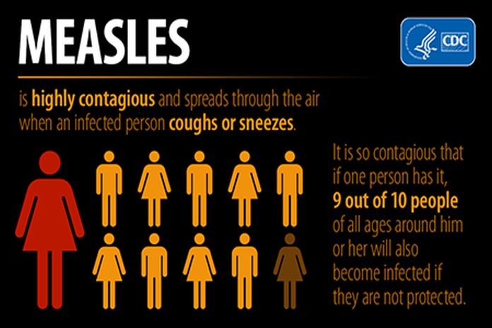 measles