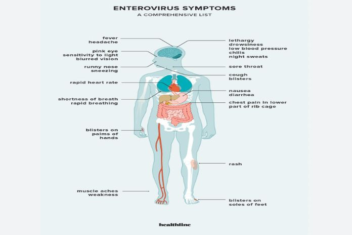 enterovirus_infection