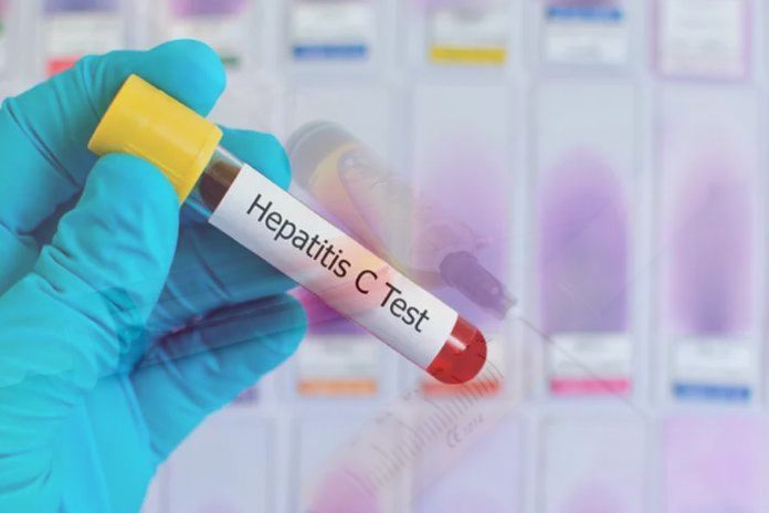 HCV