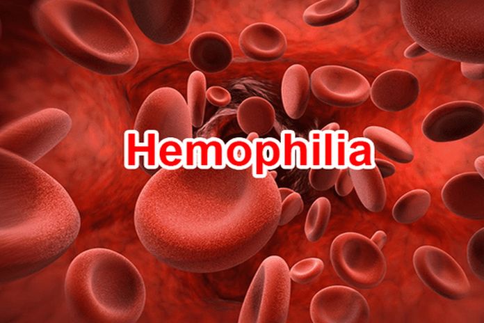 hemophilia