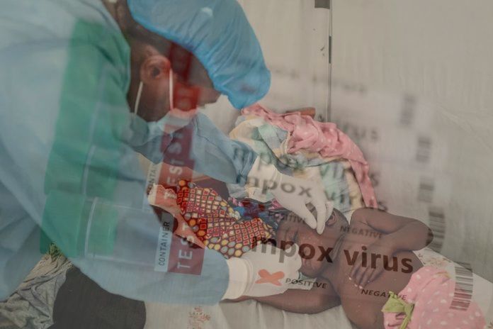 who_mpox-test