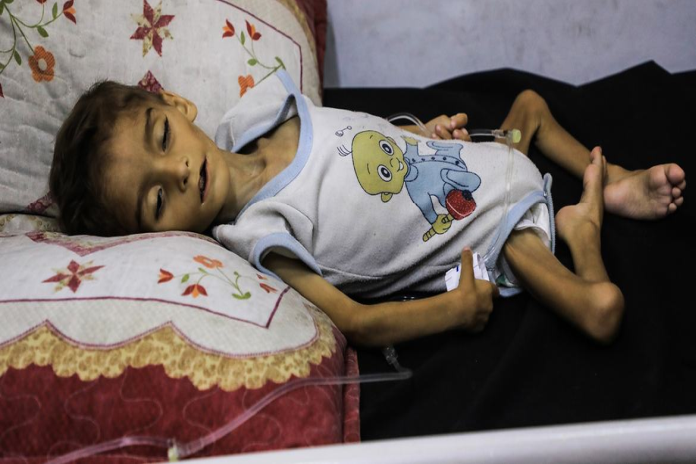 child_ suffering_gaza
