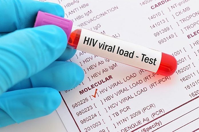 hiv_test
