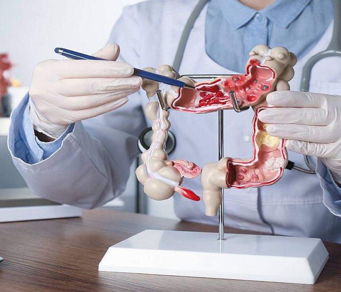 gastrointestinal_cancer